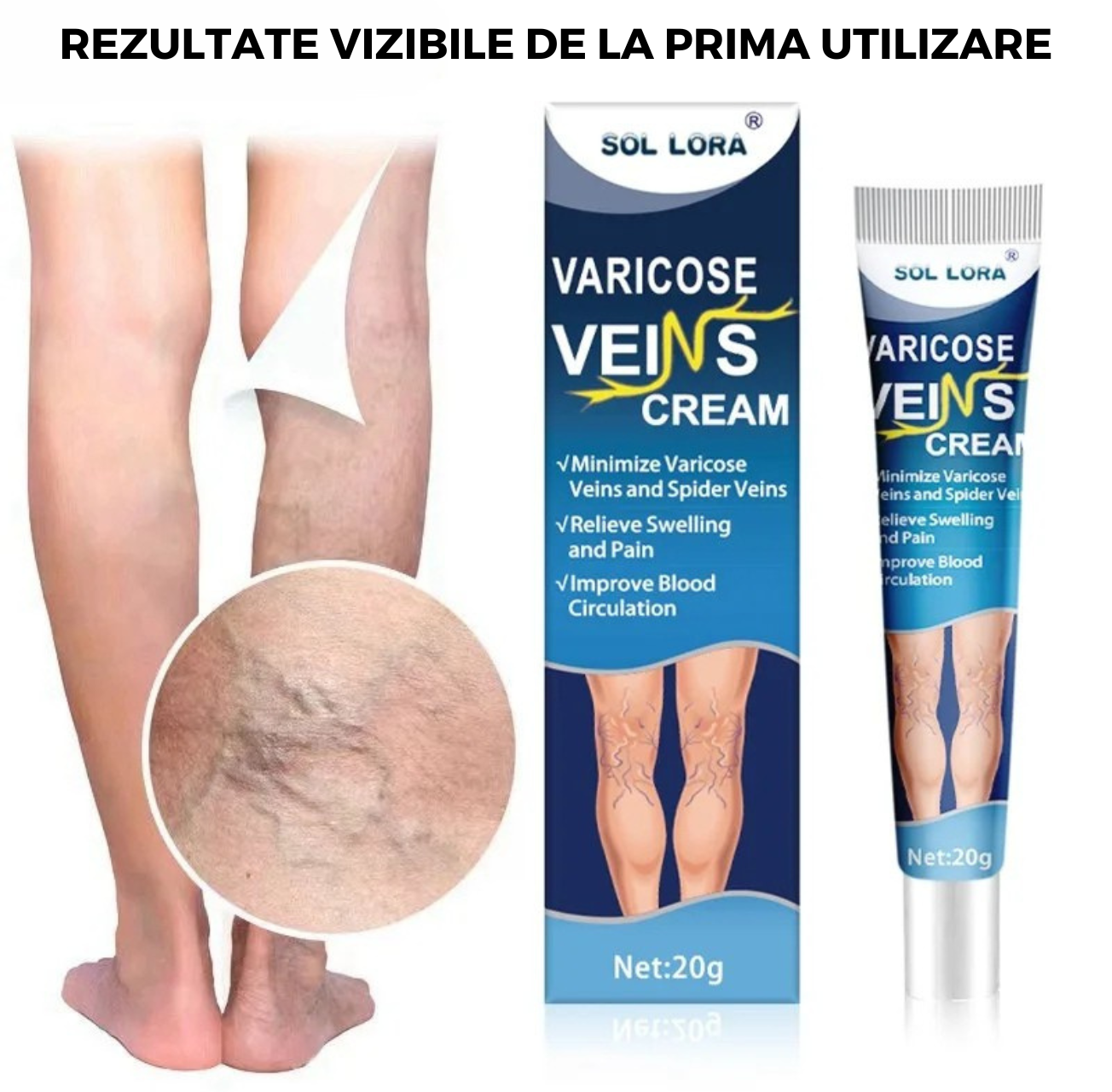 Gel Varice
