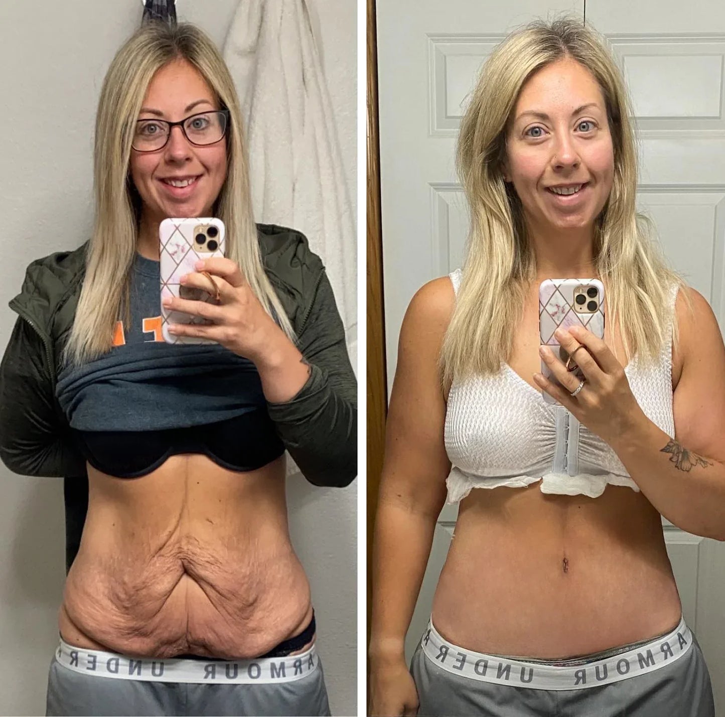 Stick Fermitate cu Colagen